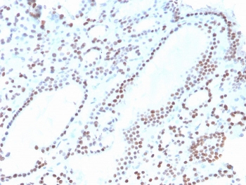 Recombinant PAX8 Antibody