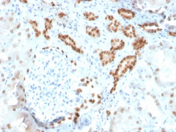 Recombinant PAX8 Antibody