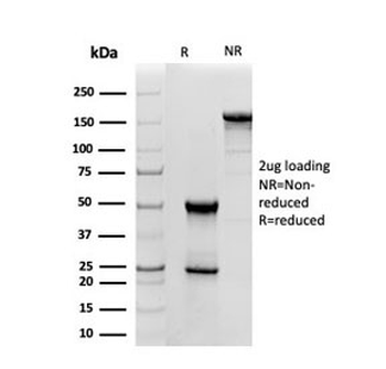 SOD1 Antibody / Superoxide Dismutase 1
