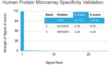 SOD1 Antibody / Superoxide Dismutase 1