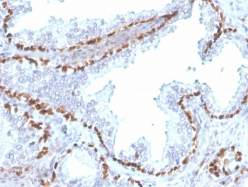 Recombinant p40 Antibody / deltaNp63