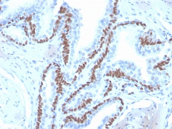 deltaNp63 Antibody / p40
