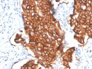 HER2 Antibody / ErbB2 / Extracellular region