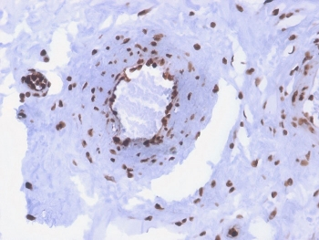 Recombinant dsDNA Antibody