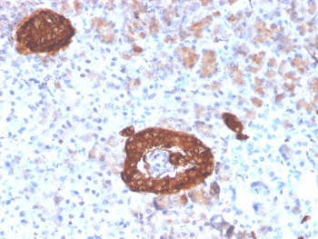 Recombinant Synaptophysin Antibody