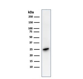 Recombinant PGP9.5 Antibody / UchL1