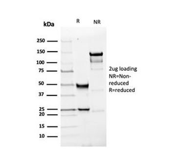 Recombinant PGP9.5 Antibody / UchL1