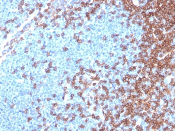 Recombinant CD4 Antibody