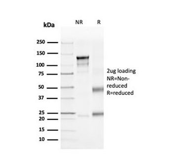 Recombinant CD4 Antibody