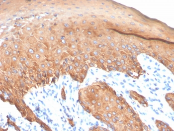 Recombinant Type I Cytokeratin Antibody (CK10/14/15/16/19)