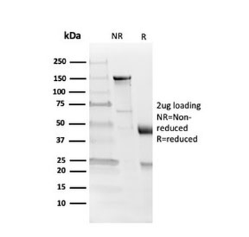 Myelin Basic Protein Antibody