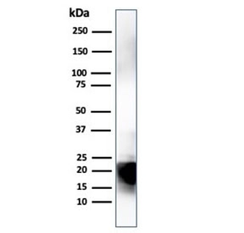 Myelin Basic Protein Antibody