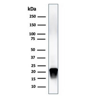 Myelin Basic Protein Antibody