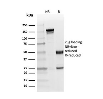 Myelin Basic Protein Antibody