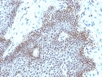 Recombinant SOX11 Antibody