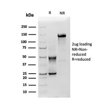 Mesothelin Antibody / MSLN