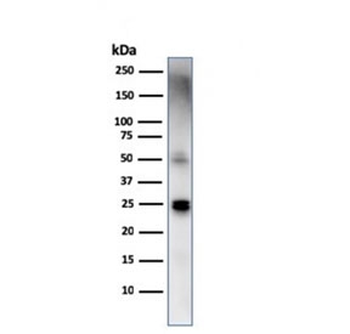 TIM-3 Antibody / HAVCR2