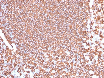 Recombinant CD20 Antibody
