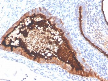 Recombinant MUC16 Antibody / CA125