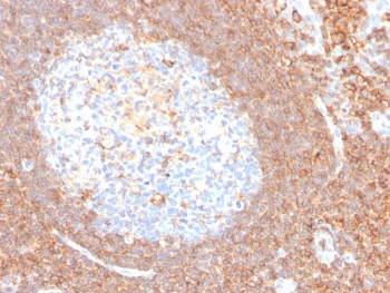 Recombinant CD44 Antibody