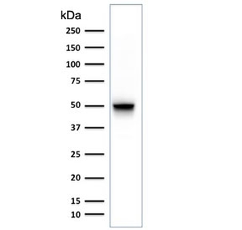 Glial Fibrillary Acidic Protein Antibody