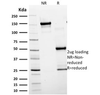 Glial Fibrillary Acidic Protein Antibody