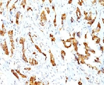 HSP27 Antibody