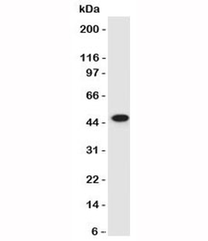 Cytokeratin 17 Antibody