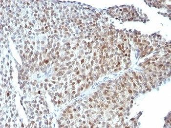 p53 Antibody