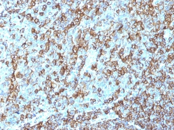 HLA-DRB1 Antibody (MHC II)