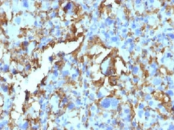 HLA-DRB1 Antibody Cocktail (MHC II)
