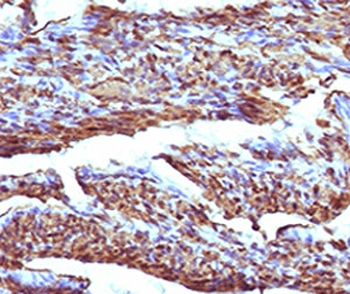 Calponin 1 Antibody