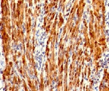 Calponin 1 Antibody