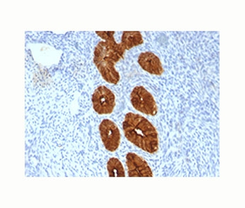 Epithelial Marker Antigen Antibody / MUC1 / Mucin-1