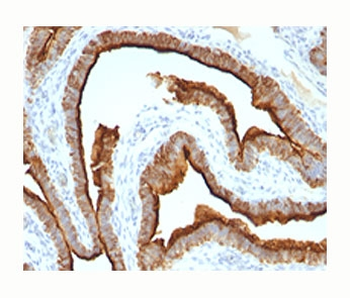 Epithelial Marker Antigen Antibody / MUC1 / Mucin-1