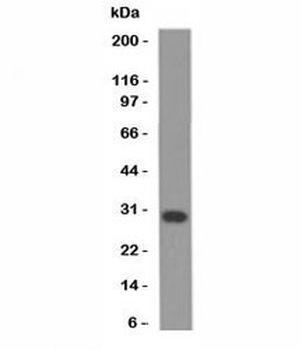 Bcl-X Antibody Cocktail