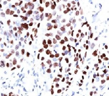 p21 Antibody