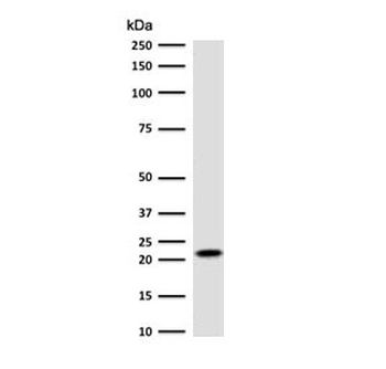 p21 Antibody
