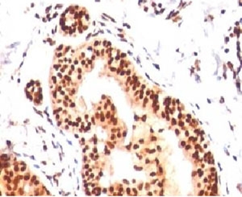 SUMO2/3 Antibody