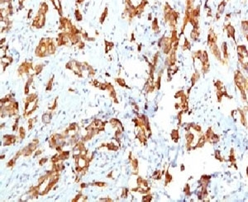 HSP27 Antibody