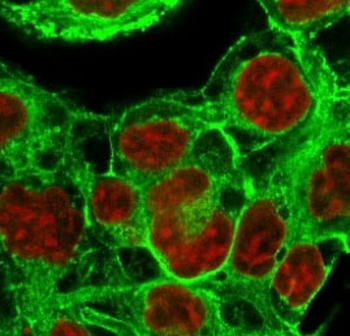 HSP27 Antibody