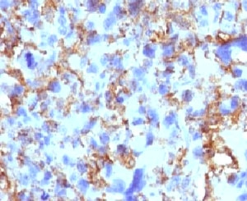 HLA-DRB1 Antibody (MHC II)