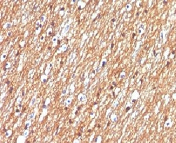 CD56 Antibody