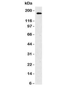 CD56 Antibody