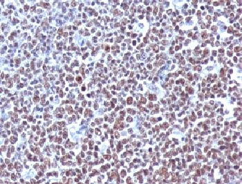 Cyclin B1 Antibody / CCNB1