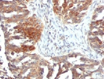 VEGF Antibody / VEGFA