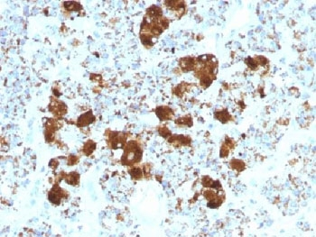 ACTH Antibody / CLIP