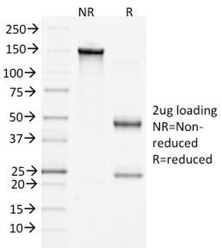 Beta Catenin Antibody