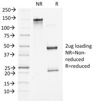 Beta Catenin Antibody
