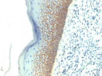 E-Cadherin Antibody / CDH1